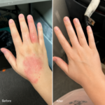 Cream for Dermatitis & Healthy Skin – Soothes itching, redness, and flaking 50ml - Image 9